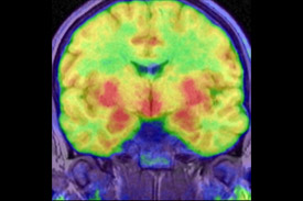 Functional MRI image