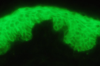 Claudin-1 protein expression in healthy human skin. Provided by Dr Rachel Watson.