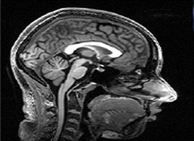 Scan of brain