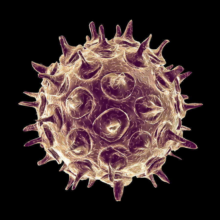 Varicella zoster virus