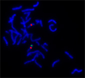 Chromosome microdeletion by fluorescence in situ hybridisation 
