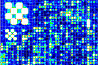 Array Comparative Genomic Hybridisation. Image provided by Professor Graeme Black