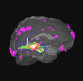 Image: 3D rendered fMRI image   