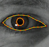 Image: Marked up image of the eye 