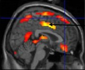 Image: Sagital fMRI brain image