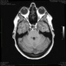 MRI brain image