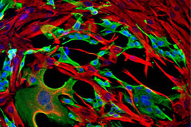 Co-culture of fibroblasts (RED) and cancer cells (GREEN) minics in vivo tumour metabolism