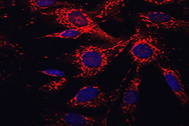 Mitochondria (RED) in human fibroblasts as visualised with MitoTracker