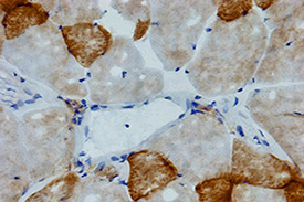 Mitochondrial activity in skeletal muscle