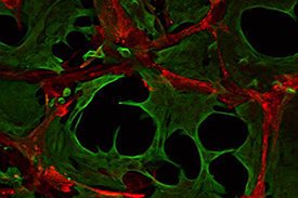 Co-culture of fibroblasts and cancer cells minics in vivo tumour metabolism