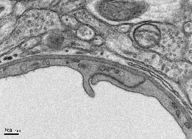 Image: Electron micrograph of a section of a blood vessel showing endothelial and smooth muscle cells
